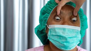 30 Pasien Jalani Operasi Mata Juling Gratis