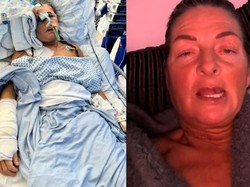 Wanita Ini Idap Kanker di Lidah, Awalnya Dikira Cuma Luka karena Tergigit