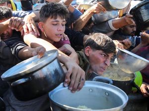 Cerita RS di Gaza Kewalahan Tangani Pasien Anak Kekurangan Gizi Cerita RS di Gaza Kewalahan Tangani Pasien Anak Kekurangan Gizi