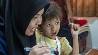Begini Proses Terapi Wicara Celah Bibir dan Lelangit