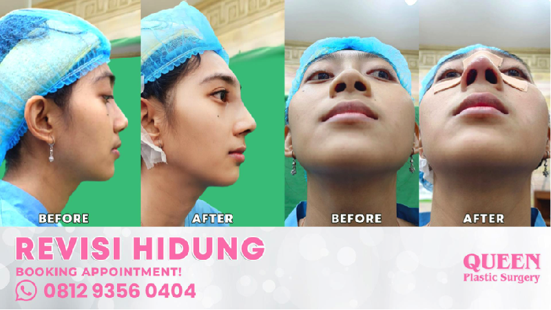 Dok Klinik Bedah Plastik Queen