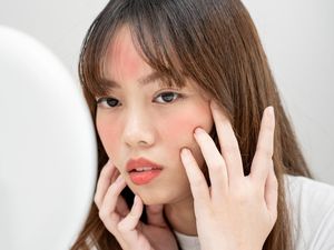 Cara Menghilangkan Jerawat Meradang dengan Cepat, Coba 7 Tips Ini! Cara Menghilangkan Jerawat Meradang dengan Cepat, Coba 7 Tips Ini!