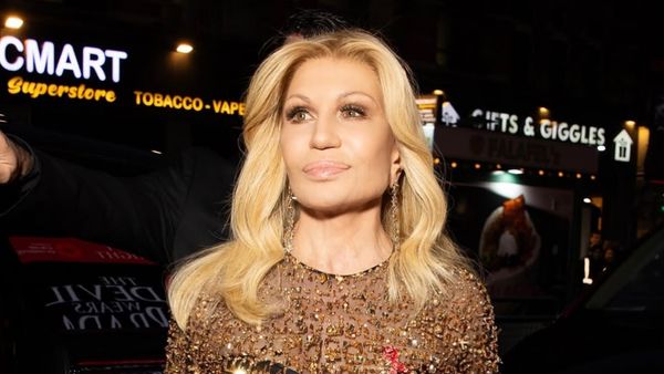 Foto: Transformasi Donatella Versace, Wajahnya Kini Berubah Diduga Oplas