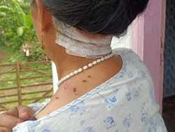 Segerombolan Monyet Liar Serang Warga Jember, 5 Orang Luka