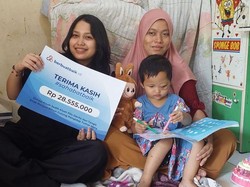 Sahabat Baik Bantu Kesembuhan Arumi, Balita Penderita Tumor Mata