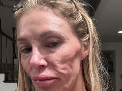 Wajah Bintang Reality TV Makin Penyok, Habiskan Rp 1 M Untuk Cari Penyebabnya