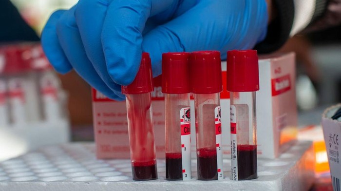 Pemeriksaan Darah untuk Antisipasi HIV Health workers arrange a teens blood sample for the Human Immunodeficiency Virus (HIV) test in Palu, Central Sulawesi, Indonesia on August 15, 2019. The test initiated by the local Health Service was intended to identify adolescents suffering from HIV and prevention efforts for transmission as early as possible. (Photo by Basri Marzuki/NurPhoto via Getty Images)