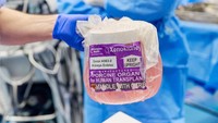 Dokter Bedah AS Uji Klinis Ginjal Babi Hasil Edit Gen untuk Didonorkan ke Manusia