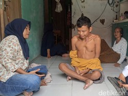 Warga Cilegon Tumbuh Keloid di Leher Seperti Akar Usai Mancing di Waduk
