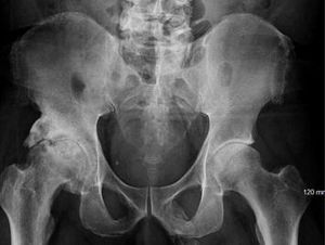 Alami Kondisi Langka, Mr P Pria Ini Mengeras dan Bertulang Alami Kondisi Langka, Mr P Pria Ini Mengeras dan Bertulang