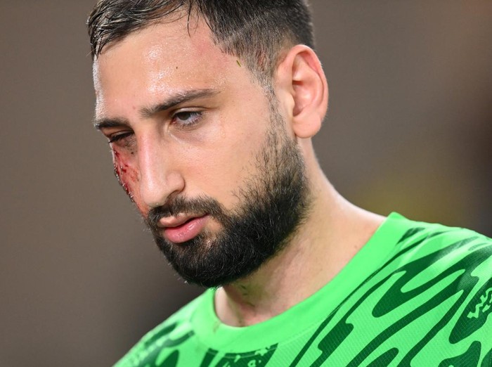 Soccer Football - Ligue 1 - AS Monaco v Paris St Germain - Stade Louis II, Monaco - December 18, 2024 Paris St Germain's Gianluigi Donnarumma reacts after sustaining an injury REUTERS/Alexandre Dimou SENSITIVE MATERIAL. THIS IMAGE MAY OFFEND OR DISTURB.