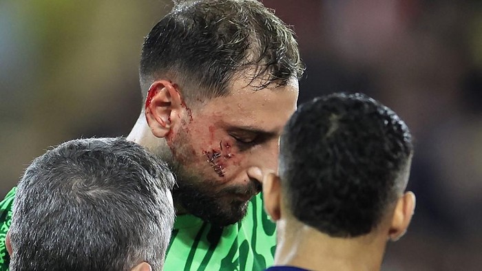 Paris Saint-Germains Italian goalkeeper #01 Gianluigi Donnarumma (C) receives medical help after sustaining an injury during the French L1 football match between AS Monaco and Paris Saint-Germain at the Louis II Stadium (Stade Louis II) in the Principality of Monaco on December 18, 2024. (Photo by Valery HACHE / AFP)