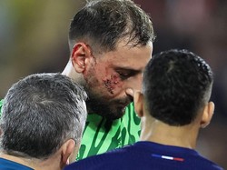 Monaco Vs PSG: Donnarumma Dapat 10 Jahitan di Wajah