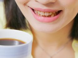 Ikuti 5 Cara Ini untuk Hilangkan Noda Kopi di Gigi