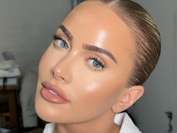 Kisah Influencer Tidak Mengenali Wajahnya Sendiri Setelah 15 Tahun Filler