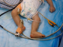 Kondisi Gaza Memprihatinkan! WHO: Butuh 5-10 Tahun Selamatkan Semua Pasien Kritis