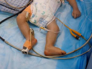 Video: Kasus Meningitis pada Anak-anak di Gaza Meningkat! Video: Kasus Meningitis pada Anak-anak di Gaza Meningkat!
