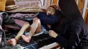 Potret Anak-anak Gaza yang Menderita Gizi Buruk