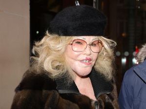 Foto Transformasi Wajah Ratu Oplas yang Meninggal Dunia di Malam Tahun Baru