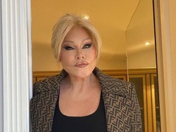 Sosialita Ratu Oplas Catwoman Jocelyne Wildenstein Meninggal saat Tidur Siang