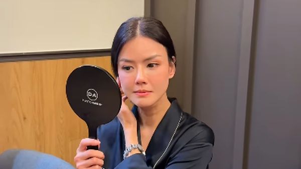 Potret Nita Gunawan Fat Grafting di Korea Demi Kembalikan Pipi yang Kempot