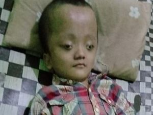 Donasi Sahabat Baik Bantu Denda, Anak Penjual Tempe Penderita Hidrosefalus