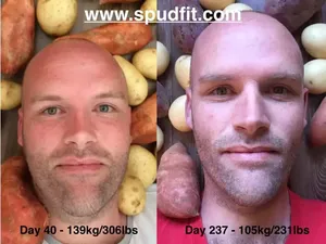 Hanya Makan Kentang Selama Setahun, Pria Ini Turun BB 50 Kg Hanya Makan Kentang Selama Setahun, Pria Ini Turun BB 50 Kg