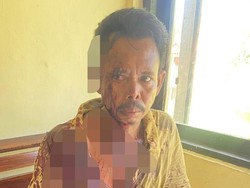 Pria di Rote Ndao Dibacok Sepupu karena Sengketa Sawah