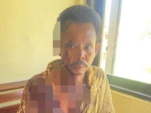 Pria di Rote Ndao Dibacok Sepupu karena Sengketa Sawah Pria di Rote Ndao Dibacok Sepupu karena Sengketa Sawah
