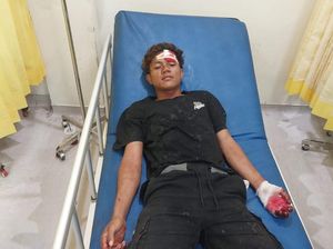 Pemuda Lekok Pasuruan Tetiba Dibacok Tetangga Saat Main HP