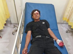 Pemuda Lekok Pasuruan Tetiba Dibacok Tetangga Saat Main HP