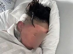 3 Bocah Prank Siram Air Panas ke Wajah Temannya, Korban Luka Parah-Dioperasi