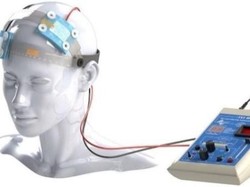 Manfaat Signifikan Neurorestorasi untuk Pemulihan Pasien Stroke