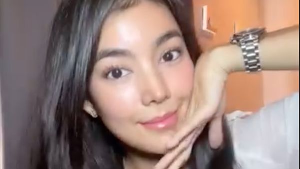7 Foto Terbaru Raya Kohandi Usai Oplas di Korea, Makin Cantik Manglingi