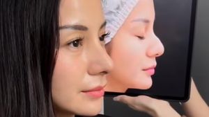 7 Foto Kirana Larasati Usai Rhinoplasty di Bangkok, Hidung Tak Lagi Bengkok