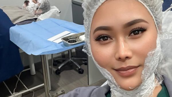 7 Foto Inul Daratista Perawatan Wajah Agar Tirus & Glowing Tanpa Oplas