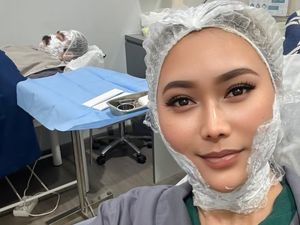 7 Foto Inul Daratista Perawatan Wajah Agar Tirus & Glowing Tanpa Oplas