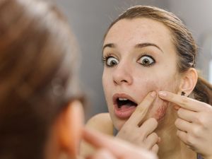 Ini Perbedaan Bisul dan Jerawat yang Perlu Kamu Tahu, Jangan Keliru! Ini Perbedaan Bisul dan Jerawat yang Perlu Kamu Tahu, Jangan Keliru!