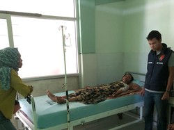 Anak yang Dibakar Ayah Kandungnya di Muara Enim Alami Luka Bakar 30 Persen