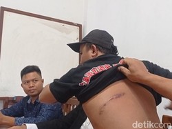 Cerita Korban Penganiayaan hingga Kasusnya Disorot Komisi III DPR