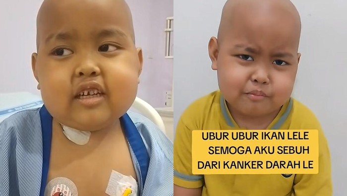 Kanker darah Anak 6 tahun mengidap kanker darah