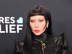 Pengakuan Lady Gaga yang Berjuang dengan Gangguan Mental Psikosis Pengakuan Lady Gaga yang Berjuang dengan Gangguan Mental Psikosis