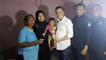 Polda DIY Bantu Pengangkatan Tumor Balita Ningsih