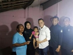 Polda DIY Bantu Pengangkatan Tumor Balita Ningsih