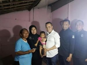 Polda DIY Bantu Pengangkatan Tumor Balita Ningsih Polda DIY Bantu Pengangkatan Tumor Balita Ningsih