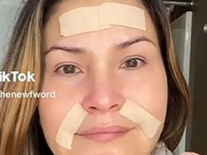 DIY Botox Pakai Selotip Viral di TikTok, Ini Komentar Dokter Kecantikan