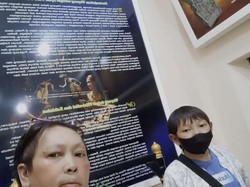 Sempat Ingin Disuntik Mati, Chusnul Penyintas Bom Bali I Kini Jual Ginjal