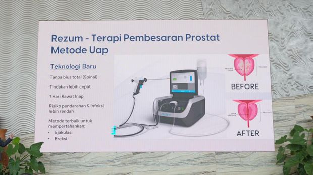 Dok RS Mandaya Puri