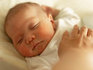 Waspada Jika Balita Anda Tidur Mendengkur, Ini Kata IDAI Waspada Jika Balita Anda Tidur Mendengkur, Ini Kata IDAI