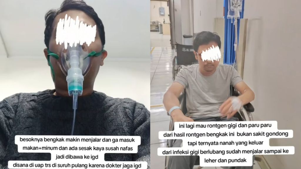 Seorang pria meninggal usai mengalami gigi berlubang.